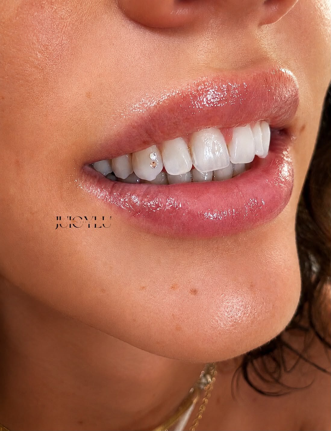 Dezente Tooth Gems mit natürlichem Lippenlook