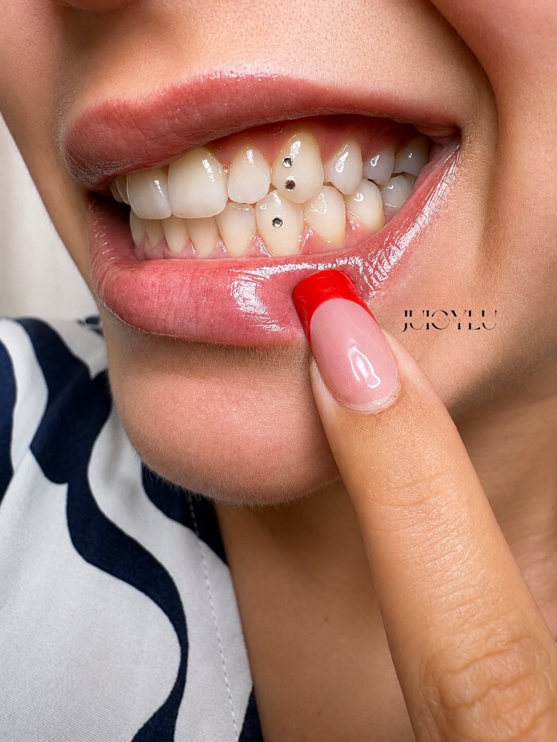 Mehrere Tooth Gems als individuelles Statement